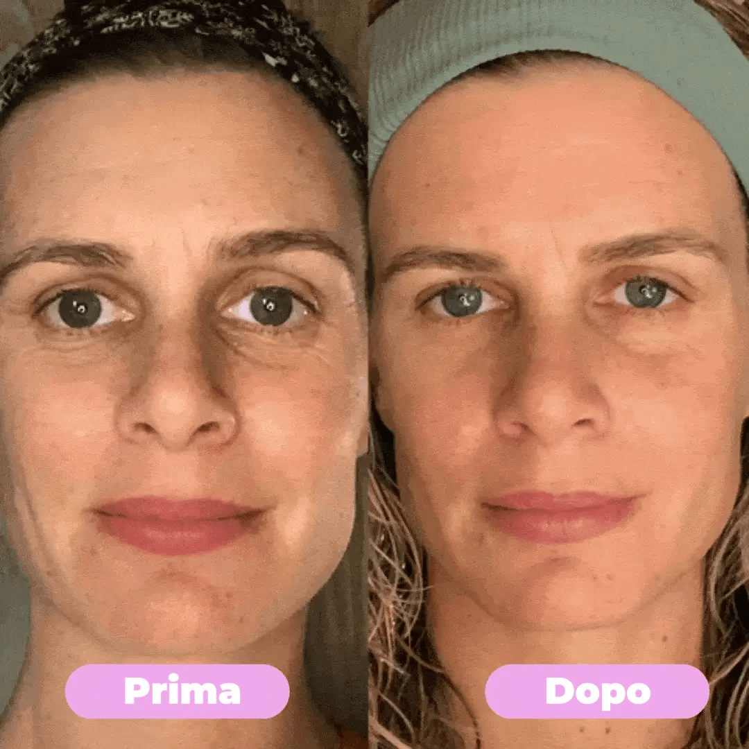 DemmyLab 7-in-1 Massaggiatore Viso LED